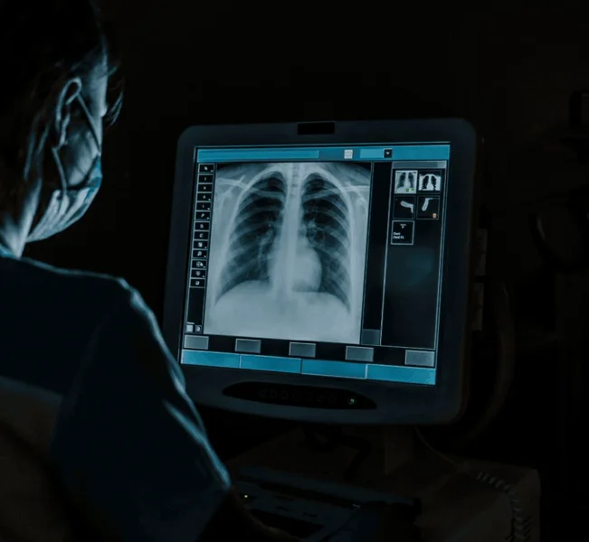 판독 모니터에 띄운 흉부 X-ray 영상 (루닛 제품 소개 이미지)